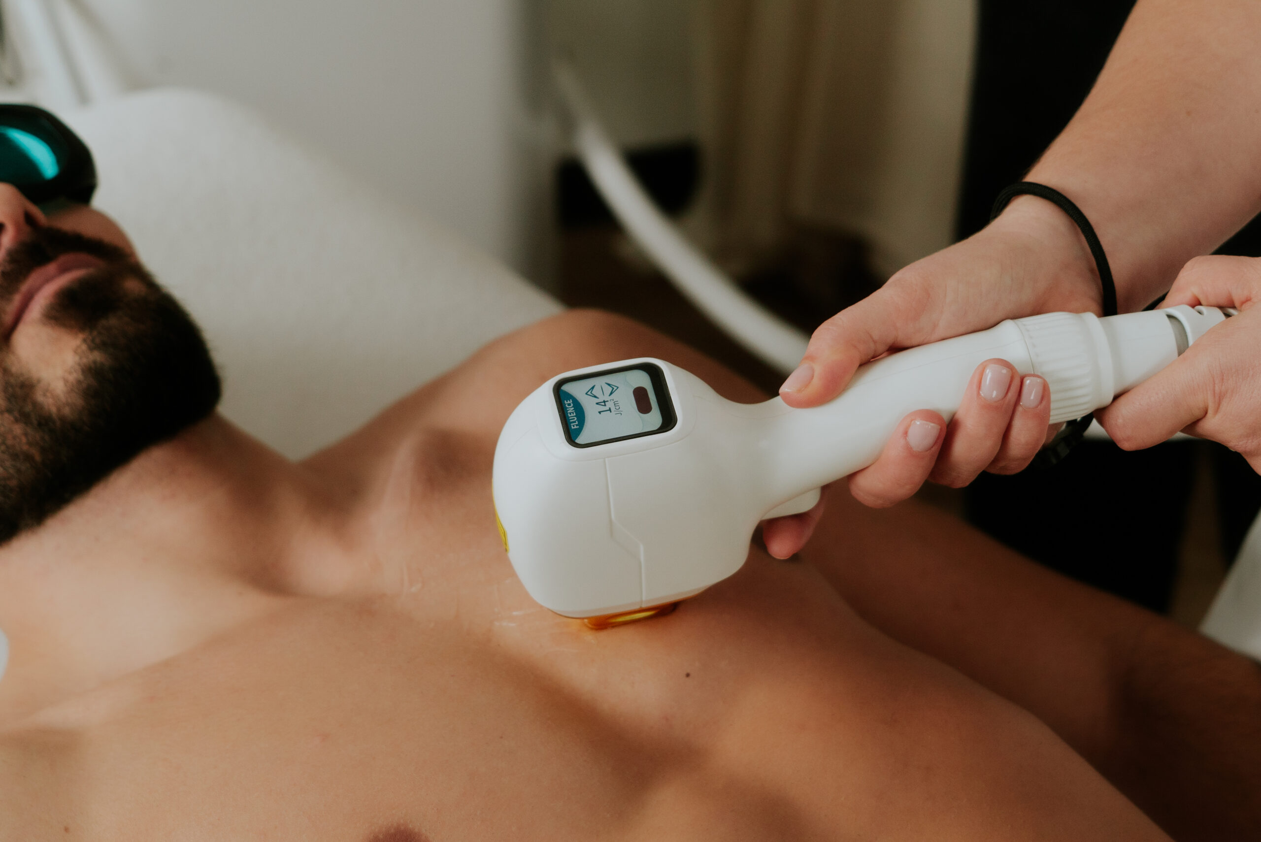 L’épilation laser est-elle faite pour moi ? Peaux, poils et zones traitables