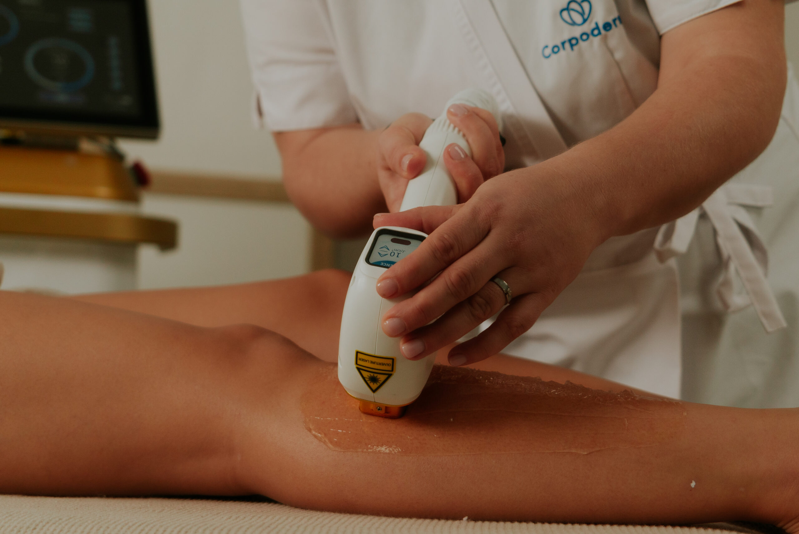 Pourquoi choisir l’épilation laser ? Avantages, résultats et idées reçues